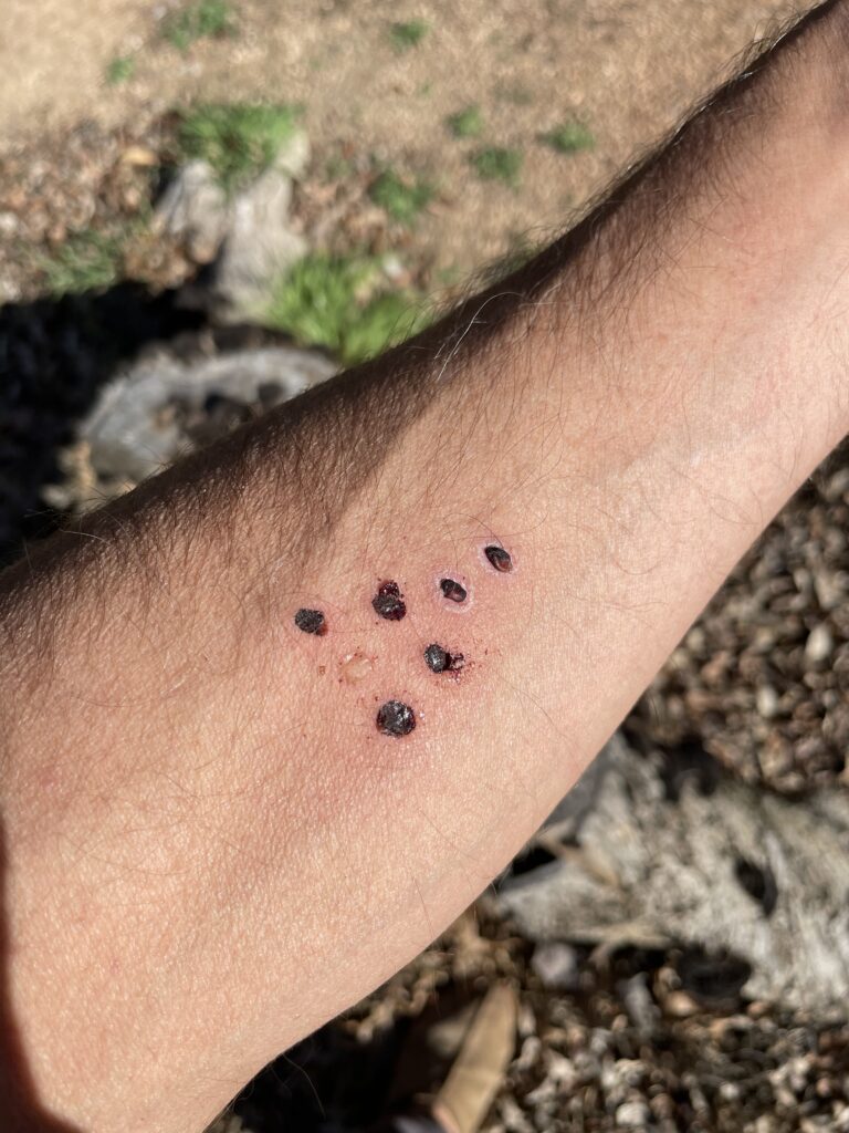 Kambo Dots